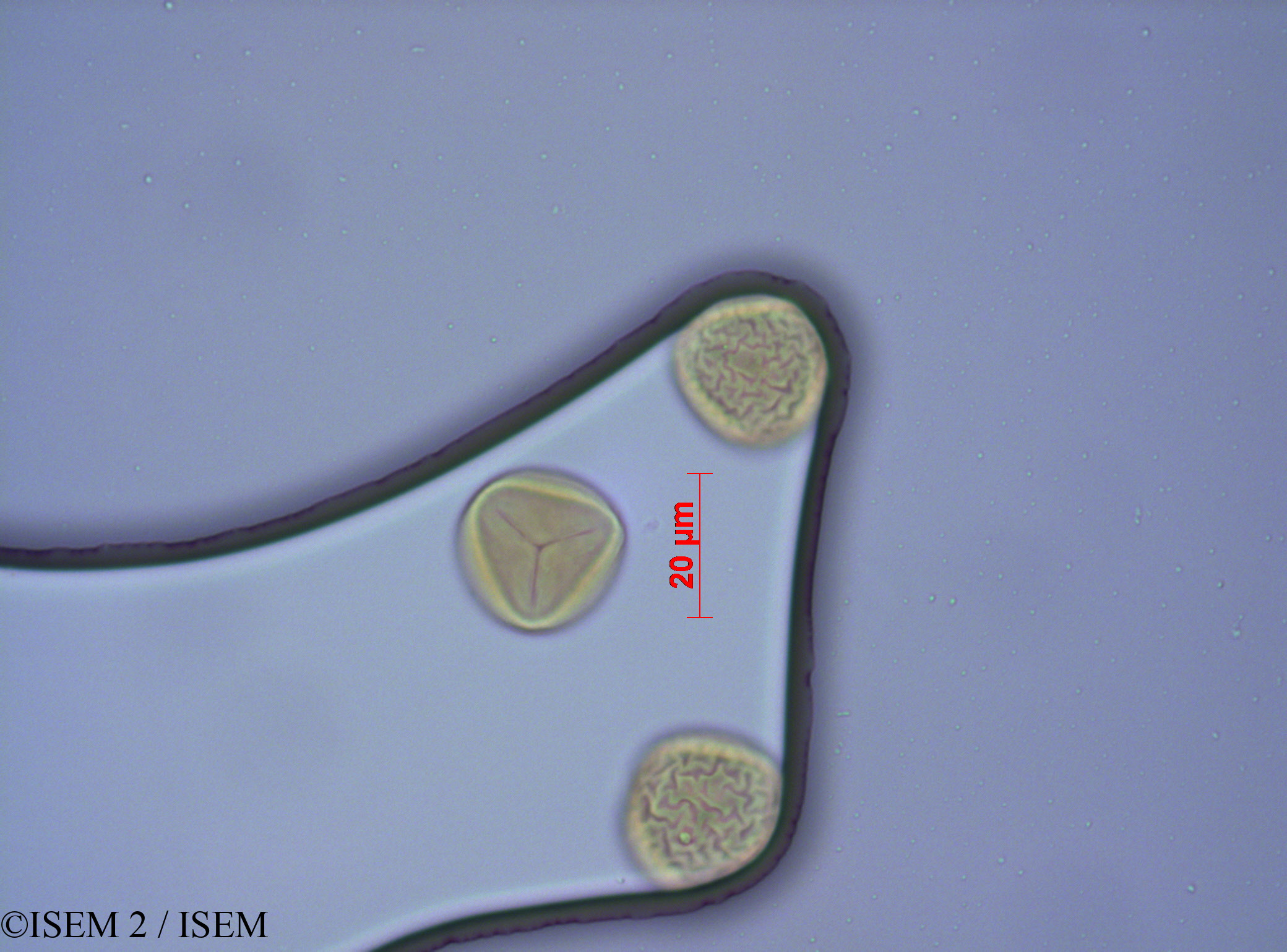 ISEM 2/Manilkara_sansibarensis_2078/Manilkara_sansibarensis_2078_0001(copy).jpg